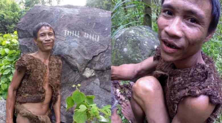 ‘Actual Life Tarzan’ Succumbs To Liver Most cancers After 41 Years of Jungle Life: How Unhealthy Food regimen Can Injury Your Liver